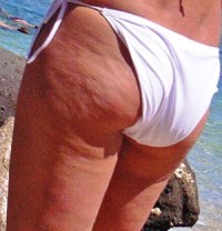 Posts related to How To Get Rid Of Cellulite Naturally At Home