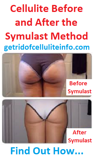 Symulast before and after pictures